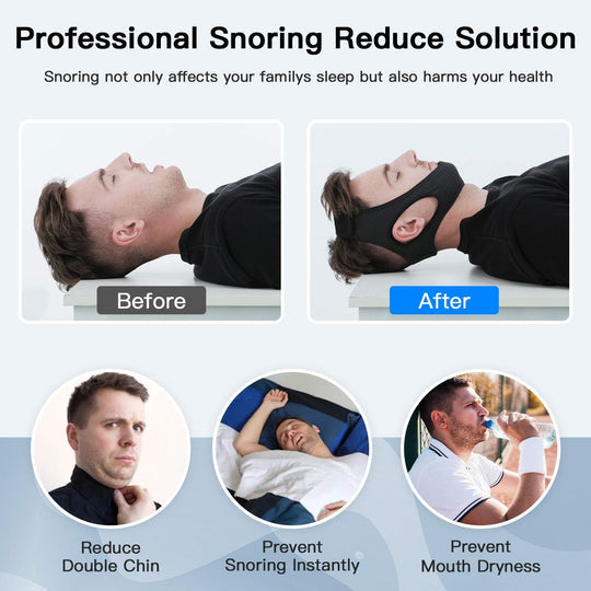 Adjustable Chin Strap with Soft Elastic Band and Hook Loop Closure for Snoring